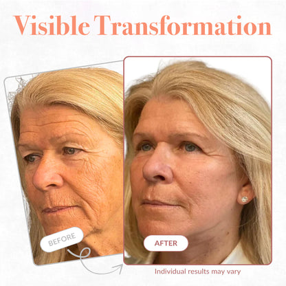 Elysielle Calcium VoluBalm